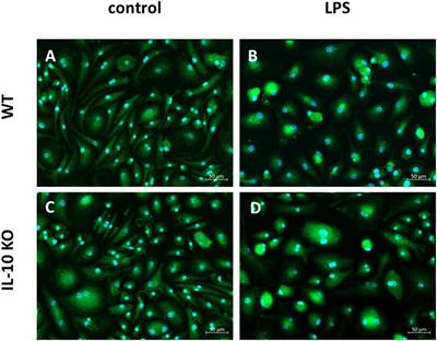 Loss of IL-10 Promotes Differentiation of Microglia to a M1 Phenotype